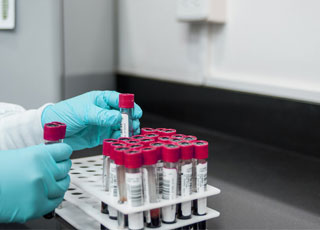 Autoanalisi Del Sangue:Glicemia,Colesterolo Totale,Profilo Lipidico